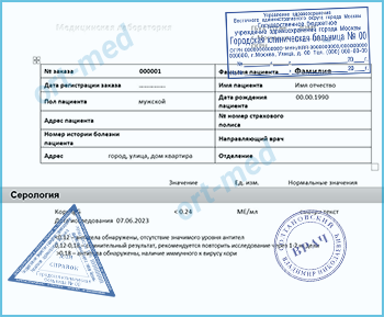 Купить справку тест на антитела к вирусу кори в Долгопрудном официально